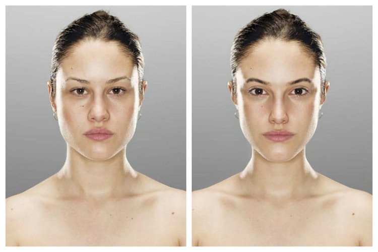 Маскулинное лицо у женщины