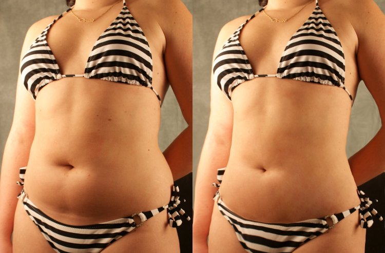 Живот девушки