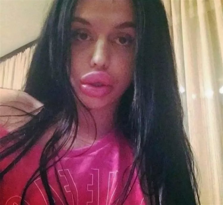 Мукла Скайлер