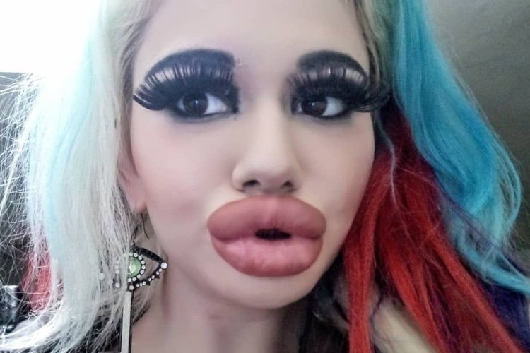 Огромные губы и ресницы