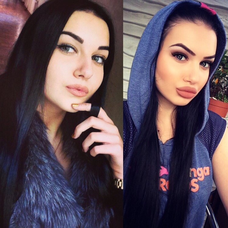 Красивые девушки с увеличенными губами