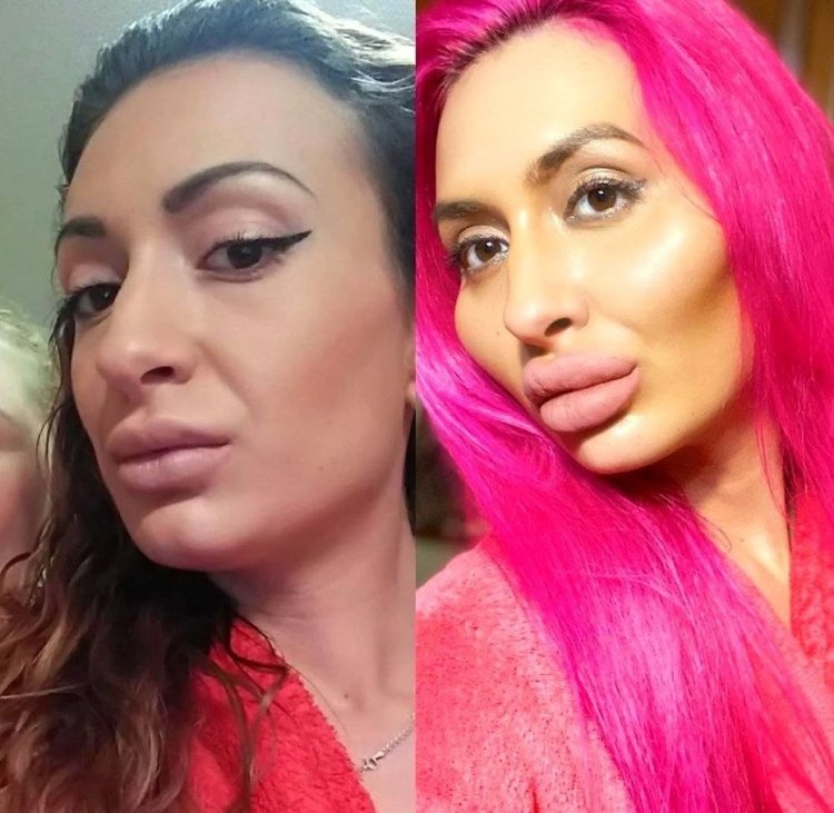 Анастасия Джаст Квин до пластики