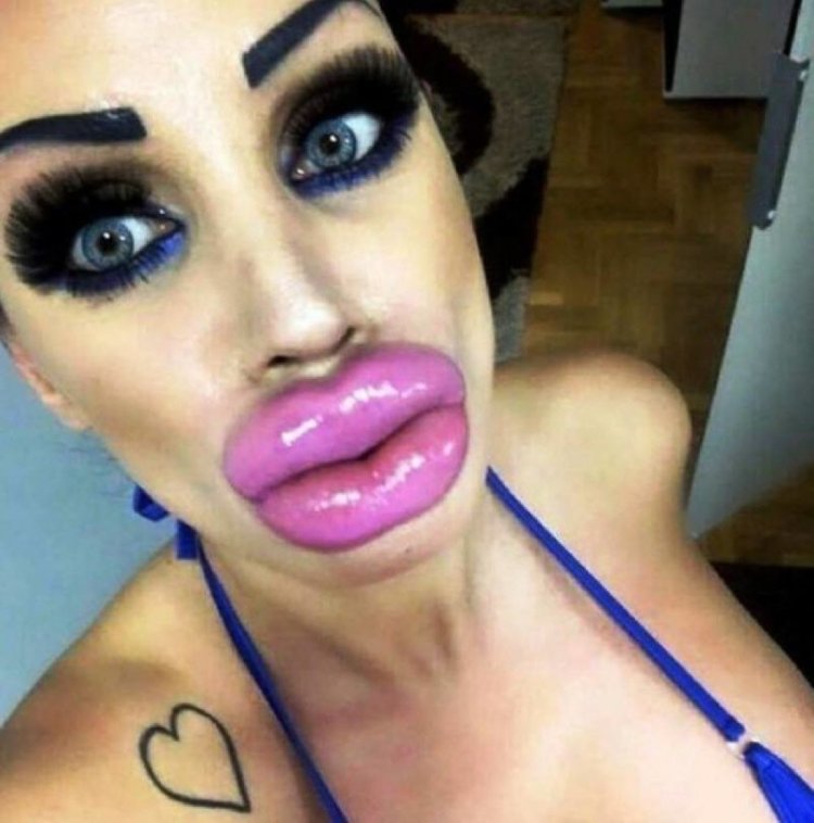 Девушки с перекачанными губами
