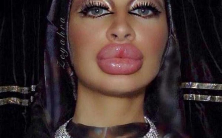 Губастые женщины