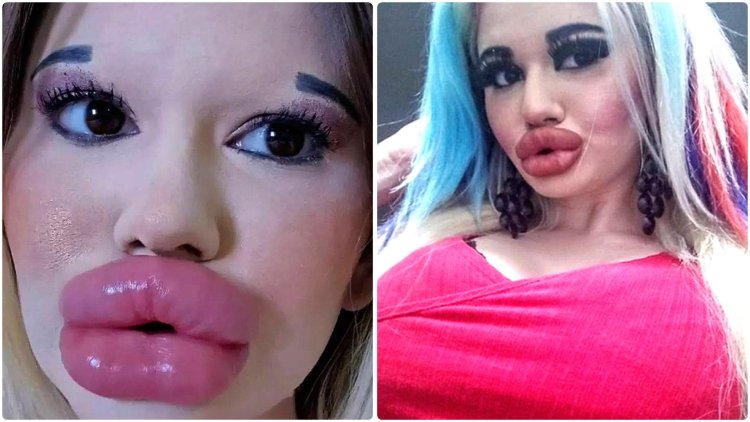 Девушка с большими губами