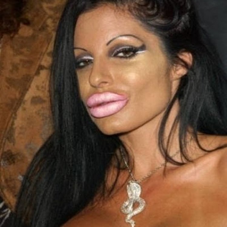 Девушка с перекаченными губами