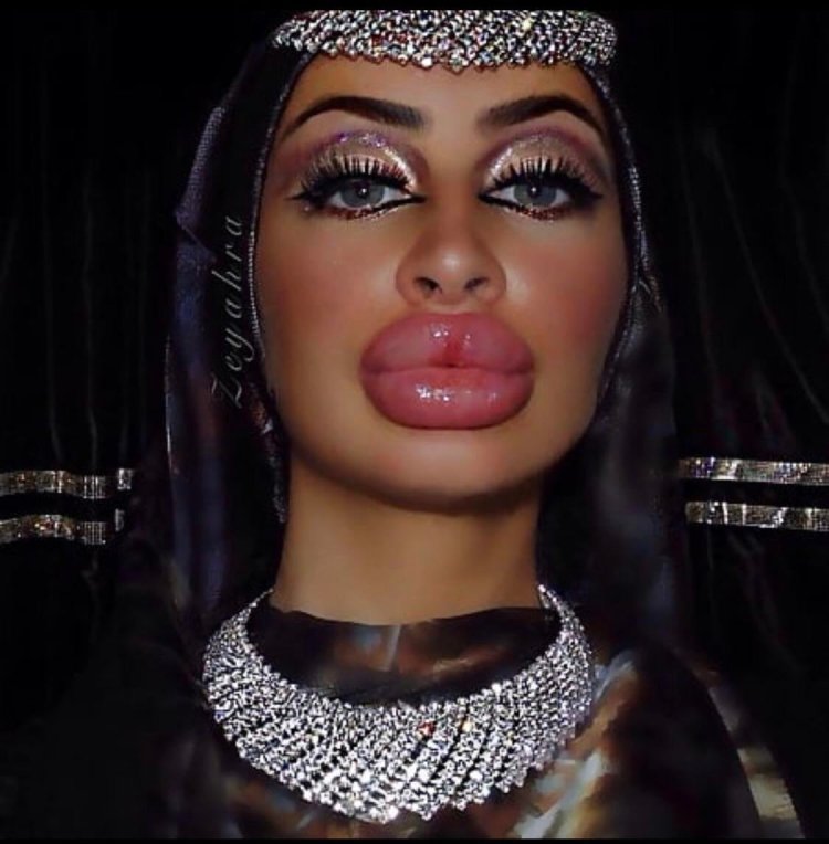 Губошлепка Кайли