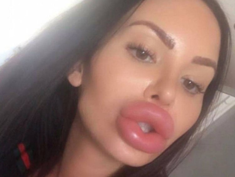 Большие перекаченные губы