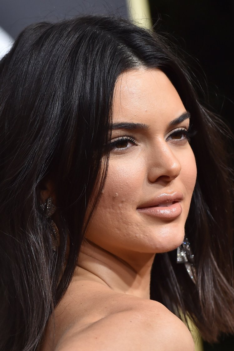 Кендалл Дженнер прыщи