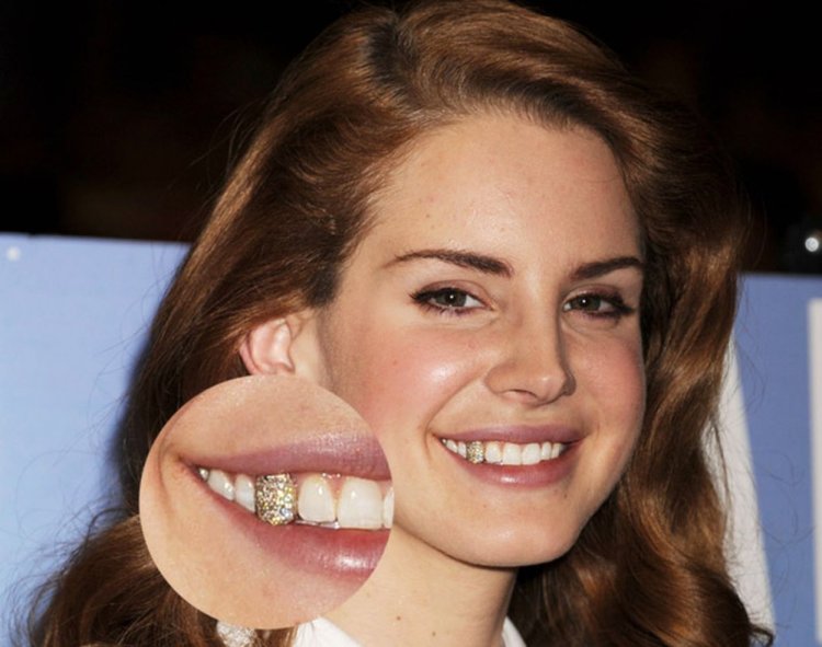 Лана дель Рей золотой зуб