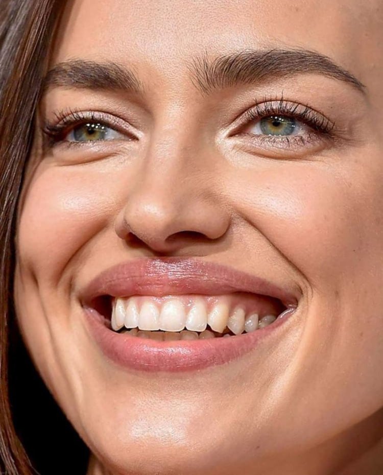 Ирина Шейк зубы