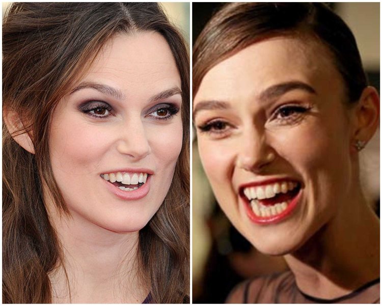 Кира Найтли кривые зубы