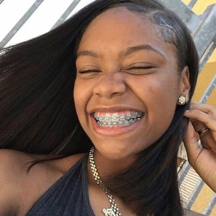 Девушка с самыми большими зубами