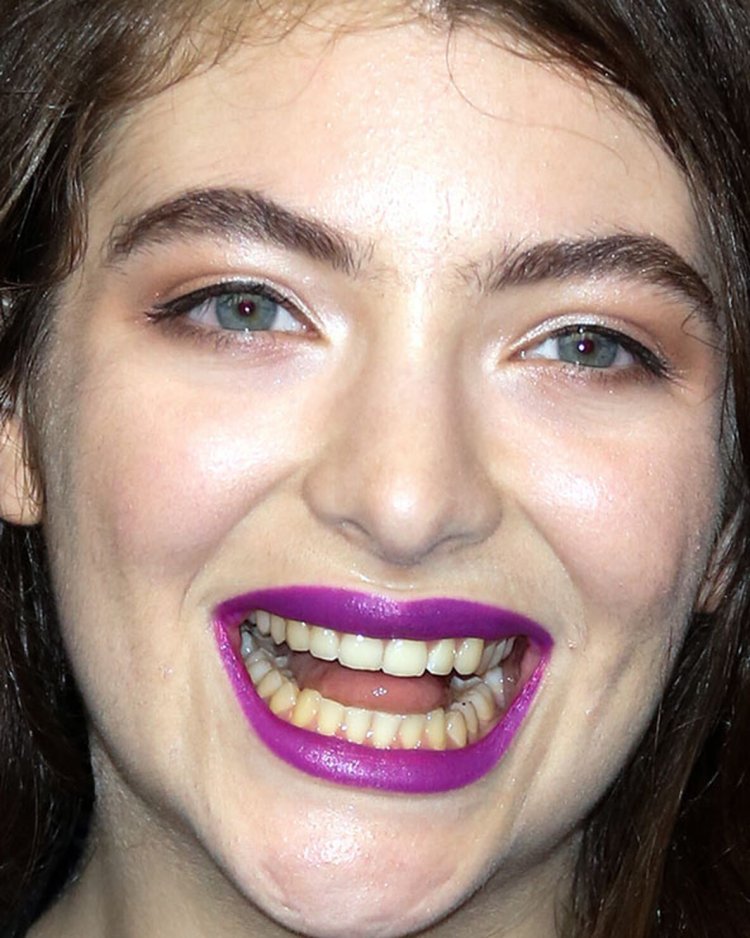 Десневая улыбка Джулия Робертс