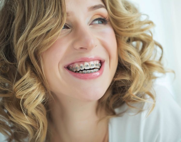 Девушка с брекетами
