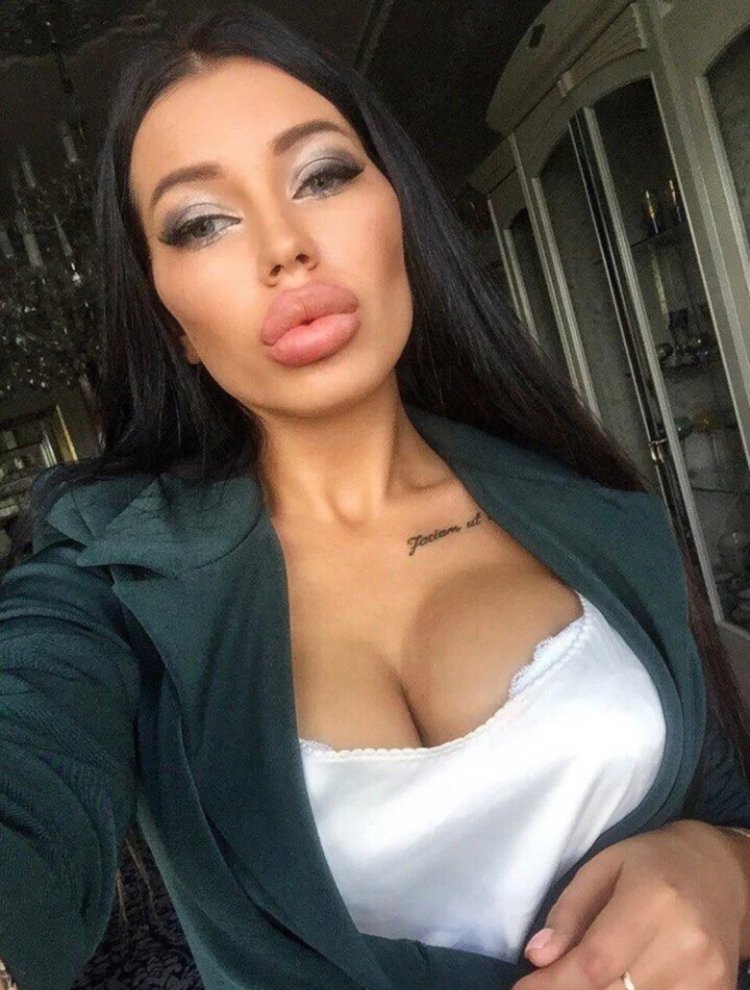 Девушки с накаченными губами и грудью