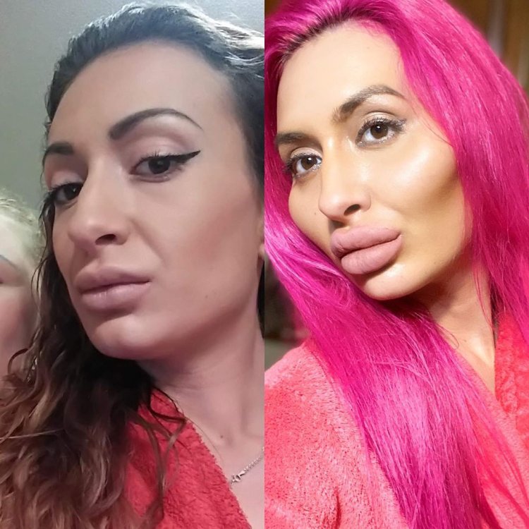 Анастасия Джаст Квин до пластики