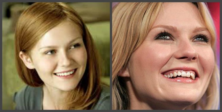 Кирстен Данст зубы