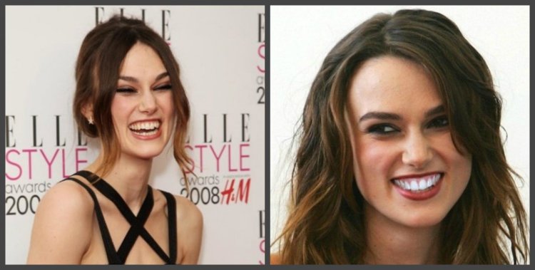 Кира Найтли кривые зубы