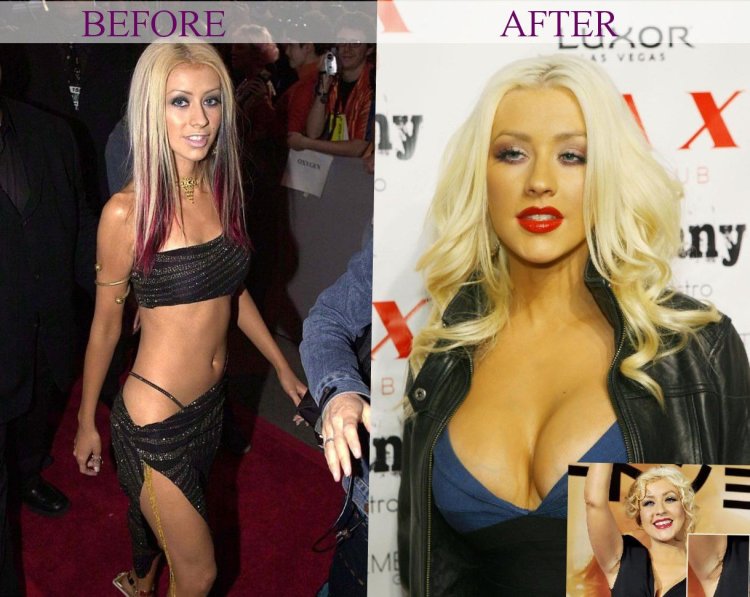 Кэт Деннингс грудь