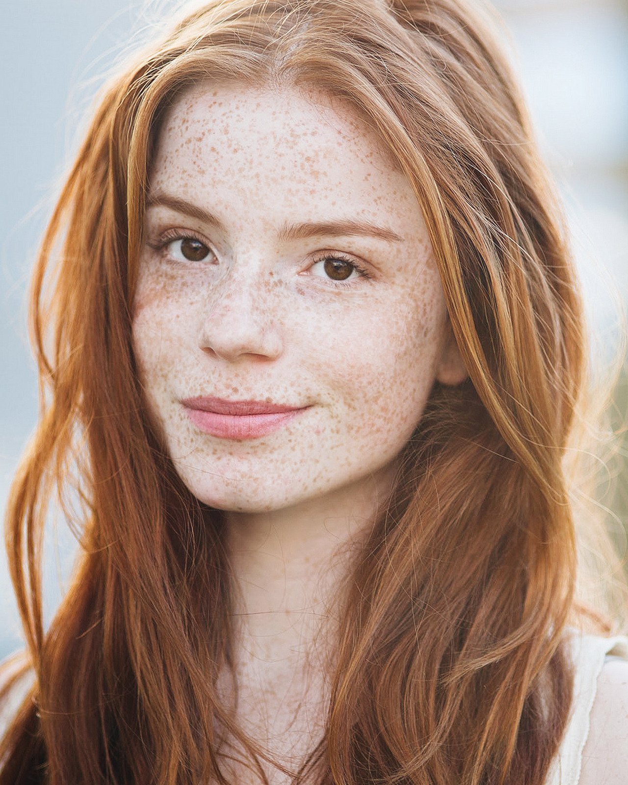 Teen Freckles