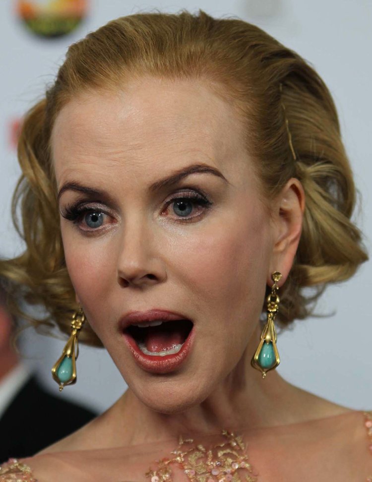 Николь Кидман ботокс