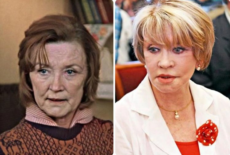 Вера Алентова после пластики 2022