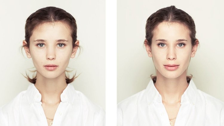 Асимметрия лица