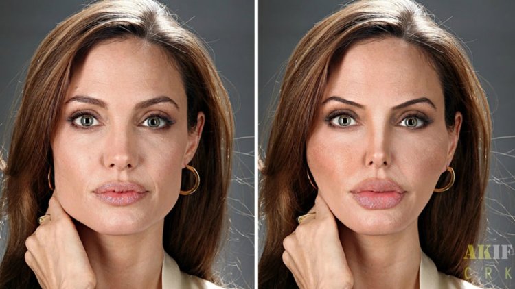 Анджелина Джоли скулы пластика