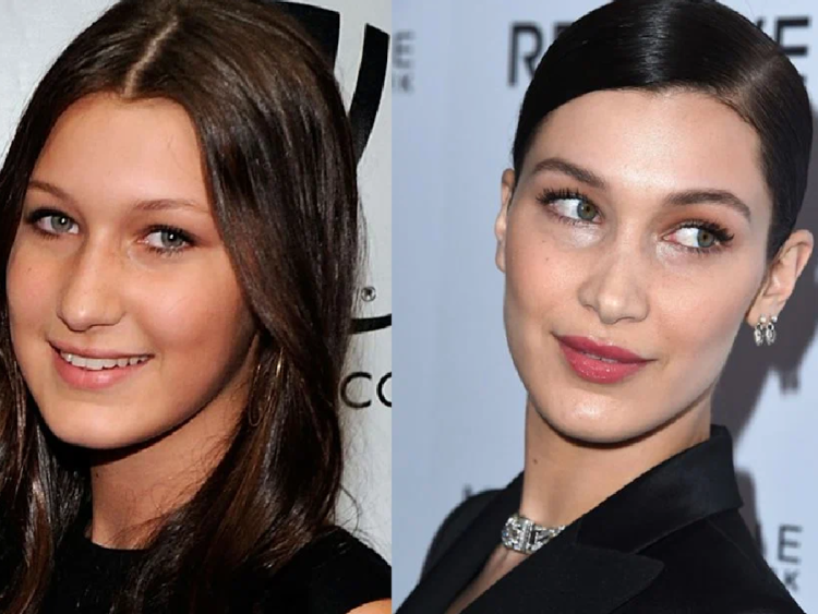 Белла Хадид до и после пластики