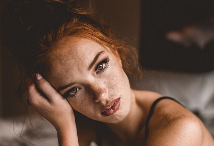 Riley Rasmussen Freckles