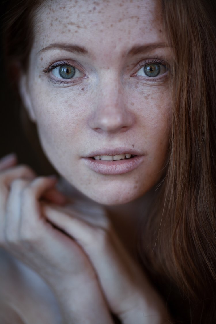 Селина Скиндер веснушки