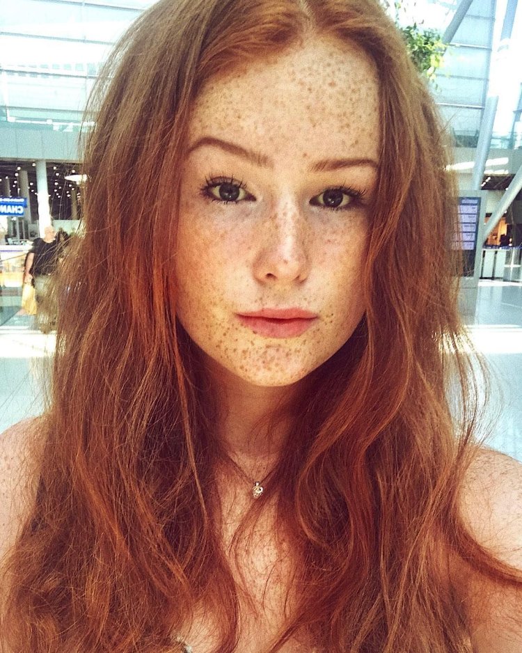 Девушка с веснушками улыбается