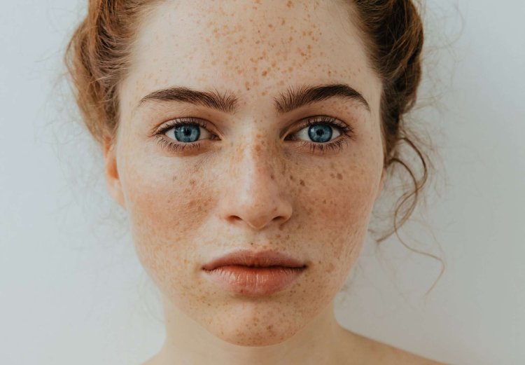 Эмили Коллинз родинки