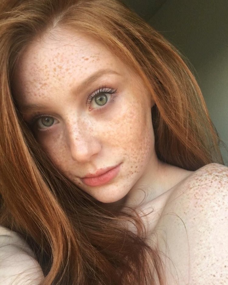 Freckles Джуди