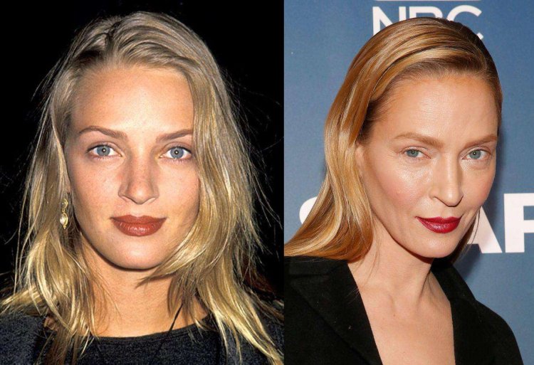 Ума Турман нос