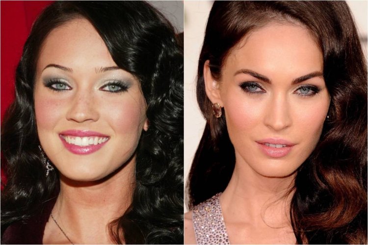 Джулия Фокс до пластики