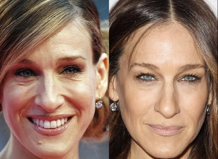 Сара Джессика Паркер с родинкой и без