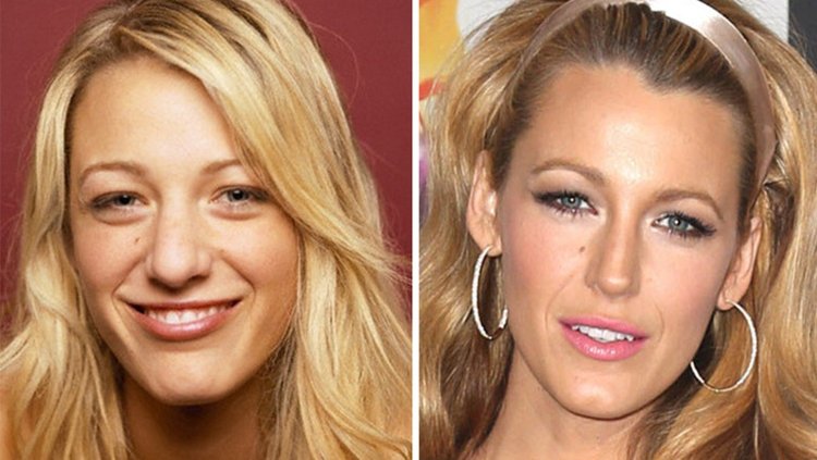 Блейк Лайвли нос