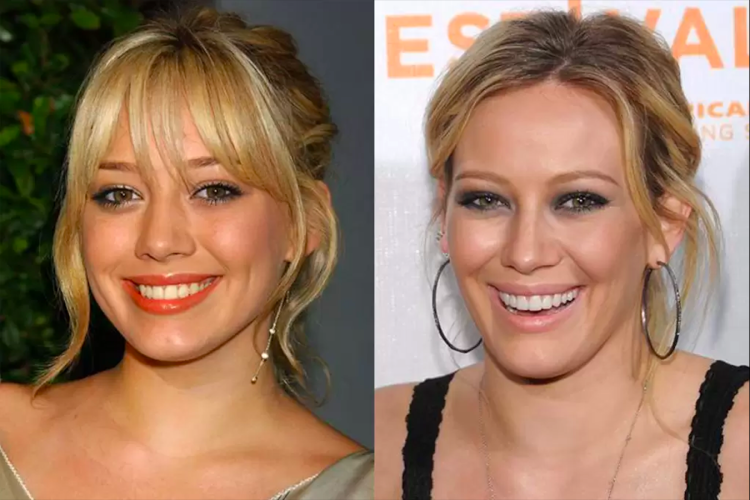 Двойной подбородок у знаменитостей