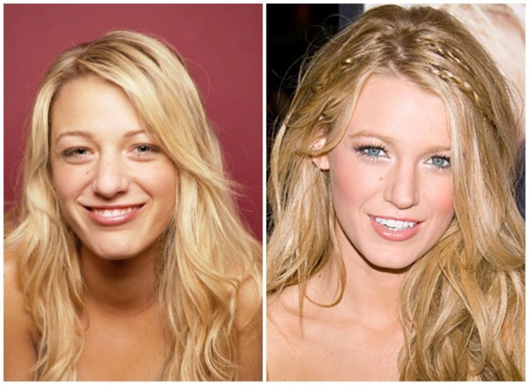 Блейк Лайвли нос