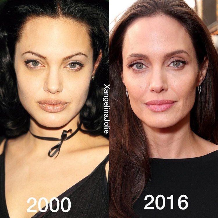 Анджелина Джоли скулы пластика