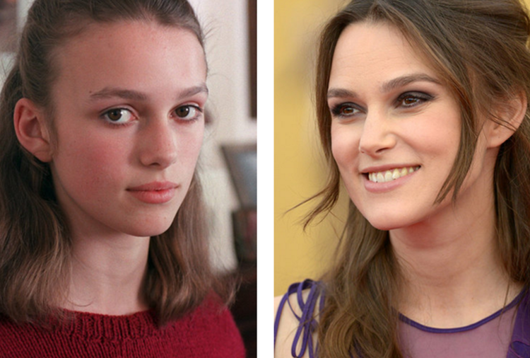 Кира Найтли до пластики