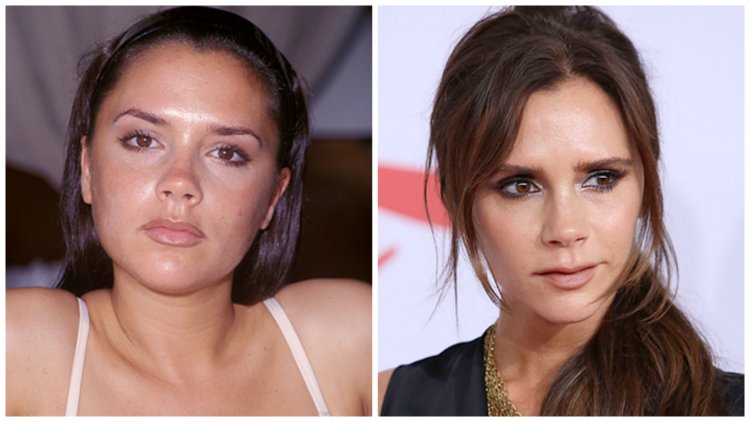 Виктория Бекхэм ринопластика