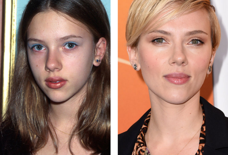 Скарлетт Йоханссон до ринопластики