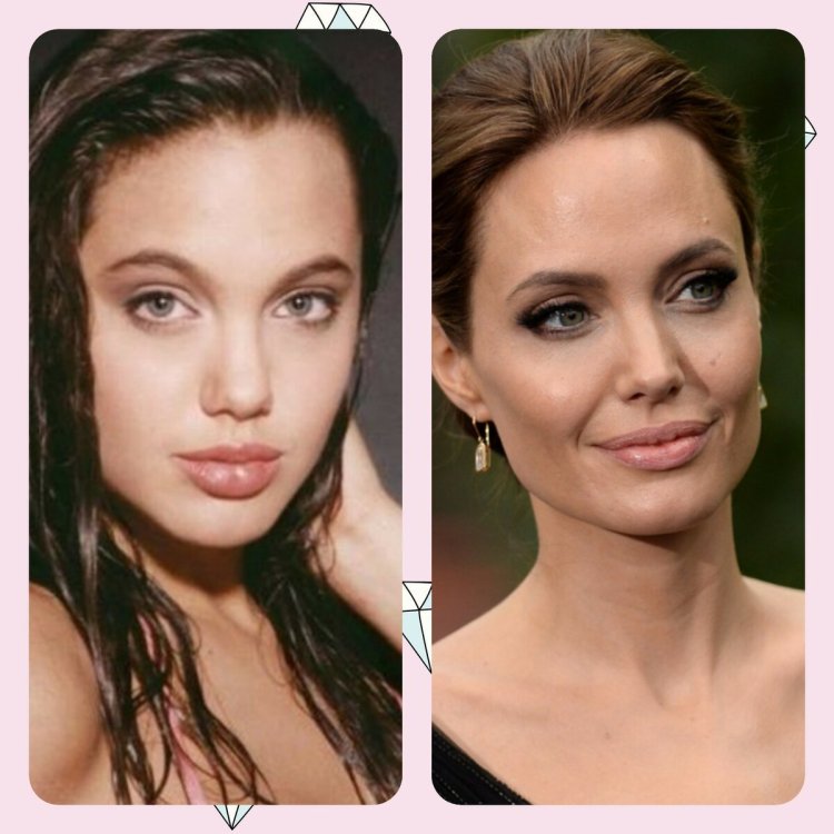 Анджелина Джоли ринопластика