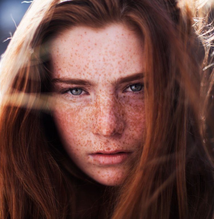 Рыжие парни с веснушками