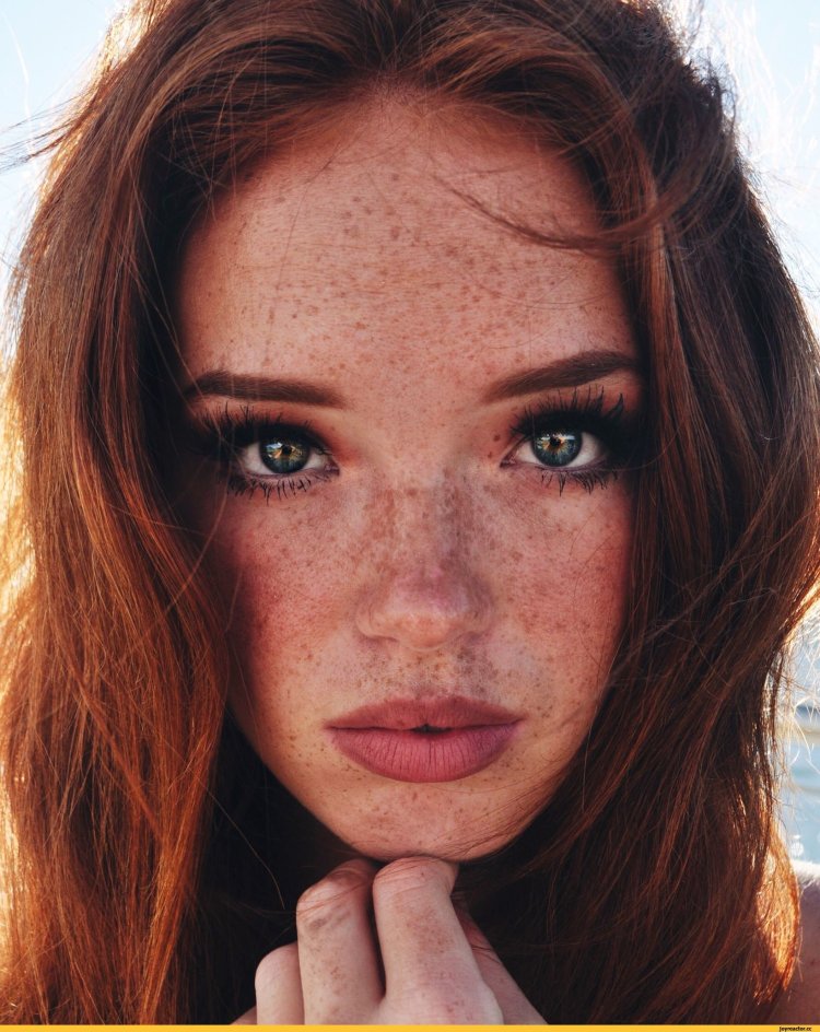 Селина Скиндер веснушки