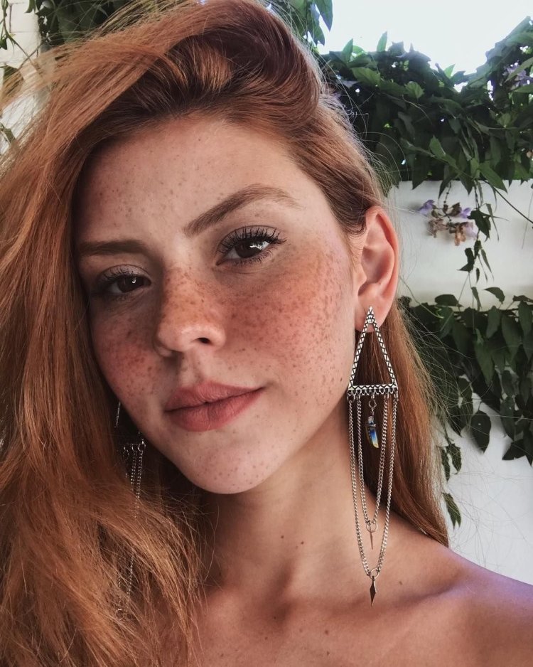 Красивые веснушки