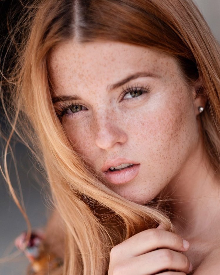 Анна Сергеевна веснушки